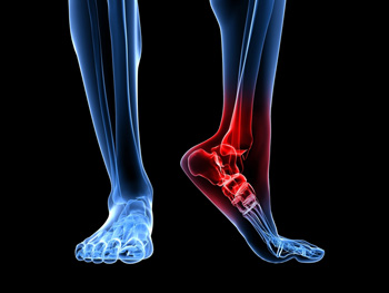 Large Ankle Causes: Understanding the Root of the Problem Beyond