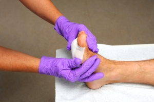 Daily Foot Care Is Essential for Diabetic Patients