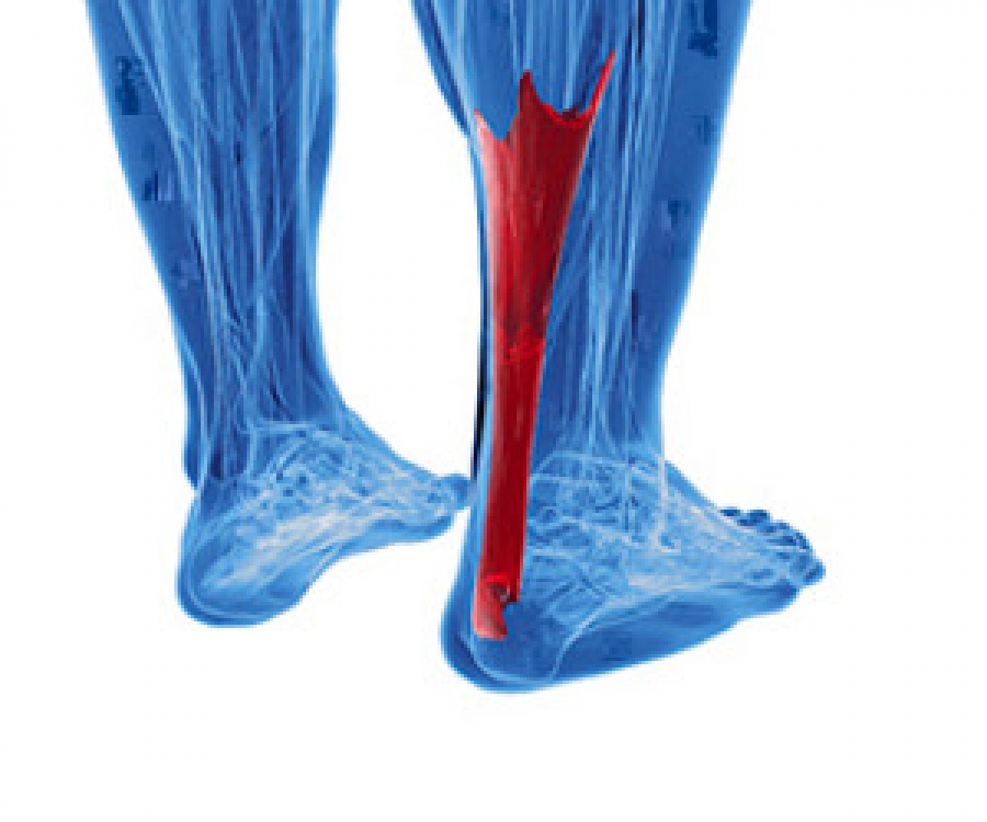 Both achilles clearance tendon pain